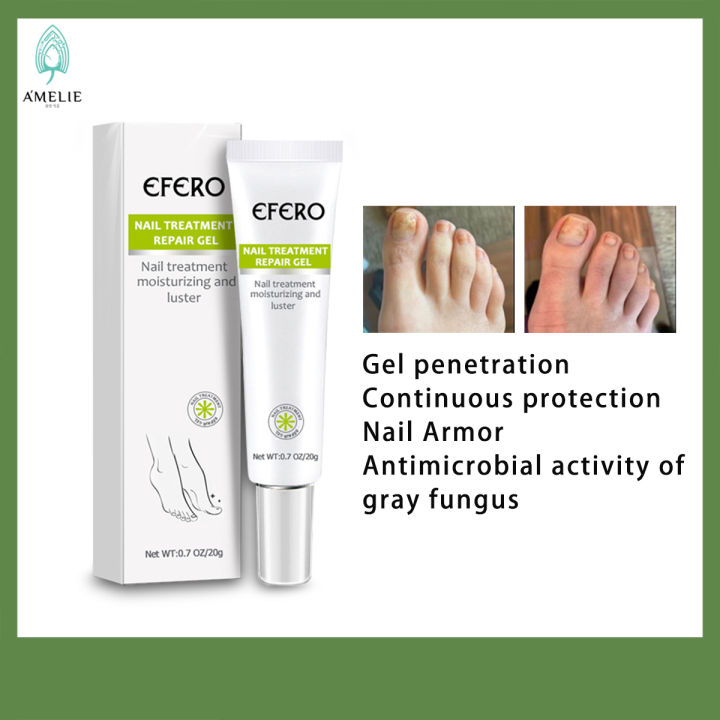 AMELIE&EFERO Nail Treatment Serum Nail Repair Gel 20g Nail Treatment