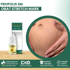Obat Stretch Mark Di Perut Garis Hitam Di Perut Obat Menghilangkan Garis Saat Hamil Obat Steck Mark Obat Berkerut Menghitam Setelah Lahiran Obat Singkayo Perut Obat Penghilang Bekas Hamil Di Perut Dengan Propolis SM