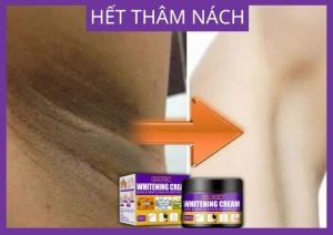 KEM DƯỠNG TRẮNG DA LOẠI BỎ NẾP NHĂN VẾT SẠM TRÊN DA TĂNG ĐỘ ĐÀN HỒI GIÚP DA CĂNG MỊN SÁNG BÓNG