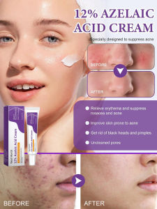 Gentle Care Facial Cream Pelargonic Acid Clarifying Cream Face Skin Lightening Repairing Cream