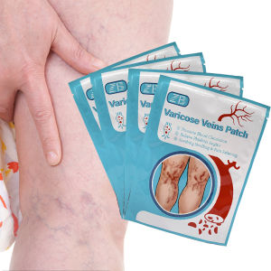 12/24 pcs Varicose Veins Treatment Patch Vasculitis Phlebitis Spider Paste Varicosity Angiitis Removal Herbal Chinese Plaster