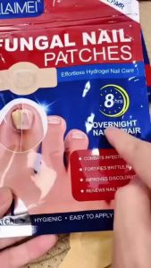 HOT Fungal Nail Patches Nail Repair Patches Antifungal 21pcs Strengthen Nails Combat Infection Ingrown Toenail Tampalan Kuku