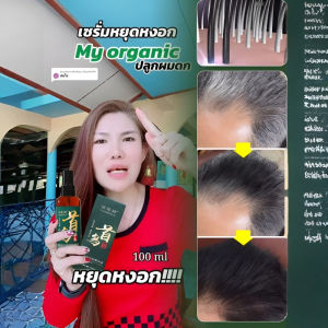 Polygonum multiflorum และ Sophora flavescens essence --- สเปรย์สมุนไพรโสม Platycladus orientalis ดูแลผมขาวถึงดำ สมุนไพรเร่งผมยาว 何首乌苦参精华液