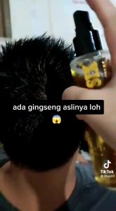 TRENDING SERUM PENUMBUH RAMBUT PELEBAT RAMBUT PEMANJANG RAMBUT BISA COD