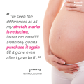 Mama’s Choice Stretch Mark Treatment Series | Stretch Mark Cream and Serum | No Paraben and Alcohol. 