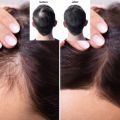 Xịt mọc tóc B.O.I. 