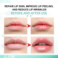 South Moon Lip Lightening Liquid Whitening Cream Pink Lips Nourish Protect Hydrated Maintenance Herbal Lip Balm Lip Care Beauty Makeup Remedy Lightening Cream Brighten Lip Color Peeling Lip Balm For Repairing Lip Line Hydrating Lip Products Overnight. 