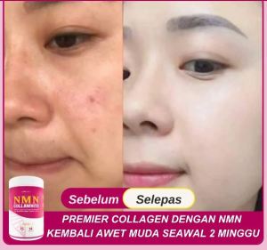 Hydrolyzed Collagen Tripeptide NMN CollaWhite cara terbaru cerahan kulit semula jadi