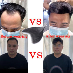 TOPQSC Hairline เส้นผมวิกผมผู้ชายหน้าผาก M-รูปหน้าผาก บางูป เปลี่ยนชิ้นที่มองไม่เห็น