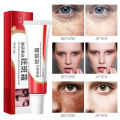 Original Whitening Freckle Cream Pekas Remover FOR ALL SKIN TYPES Melasma Remover Oitment Melasma Cream Pantanggal ng Pekas Pantanggal ng Melasma. 