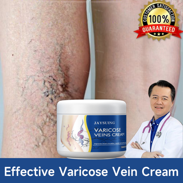 Varicose Vein Cream for Legs - Improves Blood Circulation
