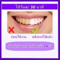 Crest 3D whitening strips ฟอกฟันขาว crest แผ่นฟอกฟันขาว ฟันขาว ฟอกฟันขาว ไม่ทําร้ายฟัน ส่วนผสมที่ปลอดภัย Luxe Professional Effects Whitestrips (20 Treatments|40 Strips). 