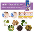 Jun shop Treatment Papillomas Removal Of Warts Liquid From Skin Tags Removing Against Moles Remover Anti Verruca Remedy BEST Skin Tags Remedy Pen Removal Liquid To Corn Grain Flat Plantar Wart Mole Gram Wart Ointment. 