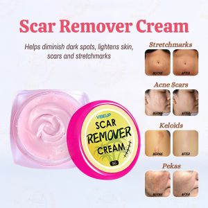 B 1 T 1 Scar-Removing Miracle Cream Fades Stretch Marks Acne Scars Dark Spots Age Spots & Everyday Scars It Also Has Anti-Aging & Brightening Effects Safe And Harmless Suitable For Pregnant Women & Breastfeeding Mothers