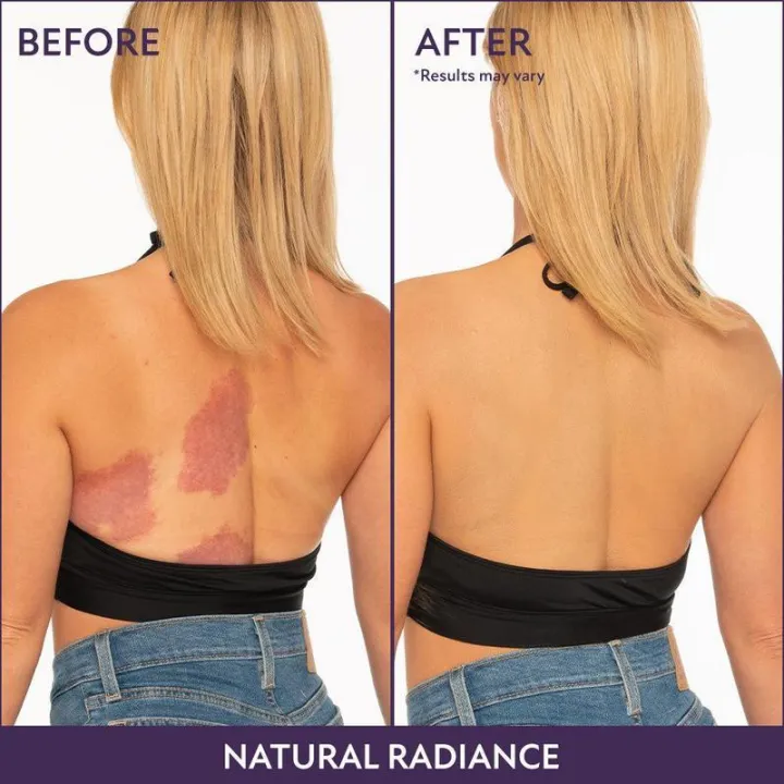 Westmore%20Beauty%20Body%20Coverage%20Perfector%203.5oz%20+%20X-Large%20Buffer%20Brush%20-%20%20Flawless%20Body%20Makeup,%20Concealer%20for%20Scars,%20Spots,%20Veins,%20Tattoos%20and%20More%20Blend%20Cosmetic%20-%20Image%203