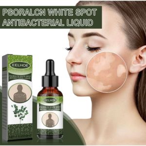 Tinh chất loại bỏ lang ben hắc lào EELHOE - Serum EELHOE hỗ trợ lang ben bạch biến hắc lào da không đều màu hiệu quả
