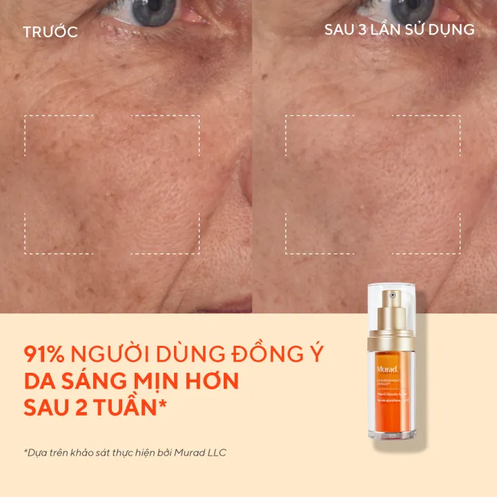%5BGI%C3%81M%20S%E1%BB%90C%20500K%5D%20Tinh%20ch%E1%BA%A5t%20h%E1%BB%97%20tr%E1%BB%A3%20s%C3%A1ng%20da,%20l%C3%A0m%20%C4%91%E1%BB%81u%20m%C3%A0u%20da%20Murad%20Vita-C%20Glycolic%20Serum%2030ml%20-%20Image%204