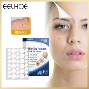 Eelhoe Skin Tags Moles Remover Patches Pimple Wart Treatment Herbal Extract Stickers Quick Absorb Plaster Warts Remover Patch Removal Warts Plaster Acne Anti-infection Invisible Hydrocolloid Face Care Patches(144pcs/box)