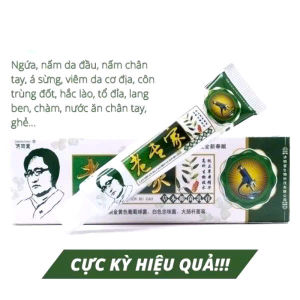 kem bôi tổ đỉa hắc lào lang bená sừngzola thần kinh ( xanh lá cây)