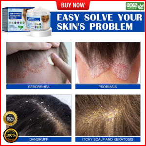 South Moon Seborrheic Dermatitis Cream Antibacterial Cream Anti Dandruff Scalp Treatment Scalp Solution