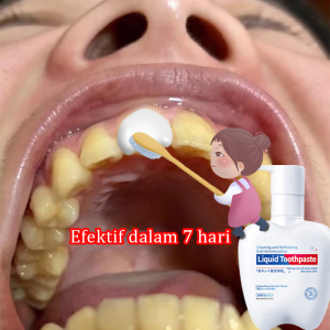 Odol Pemutih Gigi 200g Probiotik whitening toothpaste Teeth Whitening Mengurangi Plak Menghilangkan Noda Tartar Nafas Segar