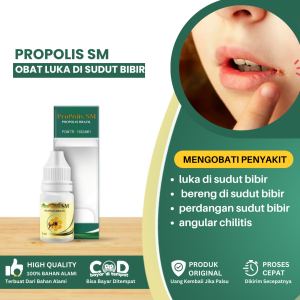 Obat Luka Di Sudut Bibir Obat Bereng Di Sudut Bibir Anak Obat Pinggir Bibir Luka Obat Peradangan Sudut Bibir Obat Angular Cheilitis Obat Berengan Pada Anak Luka Pada Sudut Mulut - Propolis SM