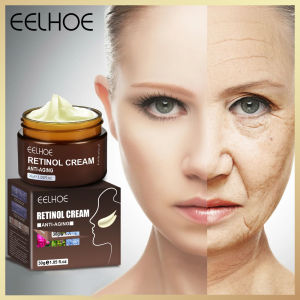 Eelhoe Retinol Cream Anti Aging Remove Wrinkle Firming Lifting Face Skin Collagen Whitening Fade Freckles Dark Spots Brightening Skin Care (30g)