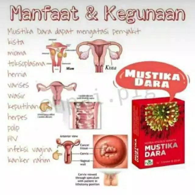 Mustika%20Dara%20/%20Mahkota%20Dara%20HNI%20Ori%20-%20Image%203