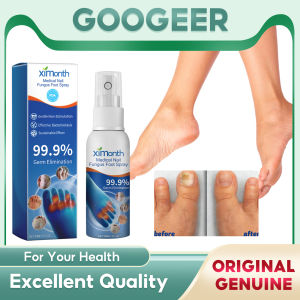 Ximonth Nail Care Spray Quick Softened Dead Skin Nutrition Serum Fluid Instant Cuticle Remover Revitalizer Feet Nourishing Hands Nail Sweaty Foot Spray Combat Feet Spray Herbal Toe Care Onychomycosis Nail Strengthener Remove Feet Odor Mist(30ml)