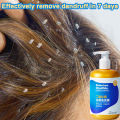 Anti dandruff shampoo，anti-itch shampoo，oil control shampoo 300ml Makes hair fresh, smooth, clean, sterilizes, and deeply cleans the scalp. It can be used by men, women, the elderly, and children.. 