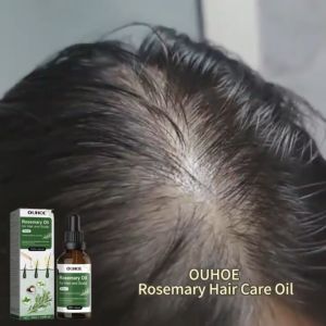 Hair Growth Oil Serum Minyak Lebatkan Rambut Anti Gugur Rawatan Rambut Jarang Lelaki Wanita Hair Loss Treatment Care LSJ