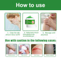 gamot sa kati kati sa balat skin fighter atoderma cream original ointments and creams eczema treatment dermacare cream for psoriasis skin deases antibacterial cream. 