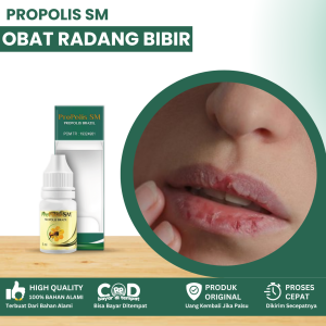 Obat Radang Bibir Obat Untuk Radang Bibir Obat Bibir Bengkak Obat Gangguan Bibir Bengkak Obat Bibir Sariawan Obat Bibir Kering Pecah Obat Bibir Pecah Berdarah Dengan Propolis SM