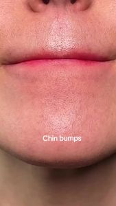 [Reday stock]VT COSMETICS CICA  Facial Mask Cleanser  2-in-1 Facial Cleanser  Non-drying Clay Mask  Gentle Pore Care  Exfoliating  Moisturizing  Centella asiatica is suitable for acne and sensitive skin  South Korea Skin Care (4.05  Fluid Ounce )