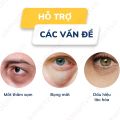 Kem Mắt Kumargic Eye Chính Hãng Ngừa Lão Hóa Hỗ Trợ Giảm Quầng Thâm & Bọng Mắt 20g. 