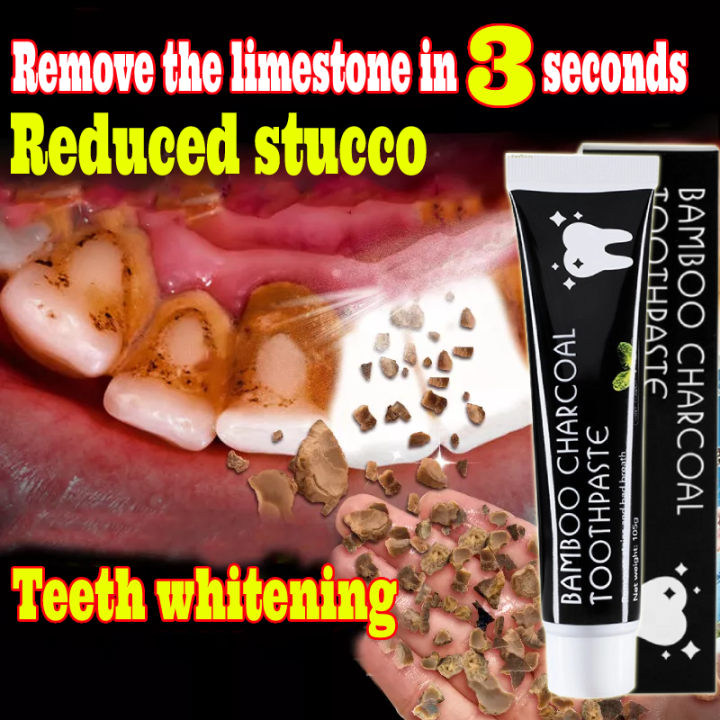 [COD] Teeth Whitening Teeth Cleaning Mousse White Teeth Oral Hygiene ...