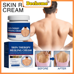 South Moon Skin Therapy Healing Cream Skin Antipruritic Cream Moisturizing Treatment Cream Psoriasis Cream Dermatitis Eczematoid Ointment
