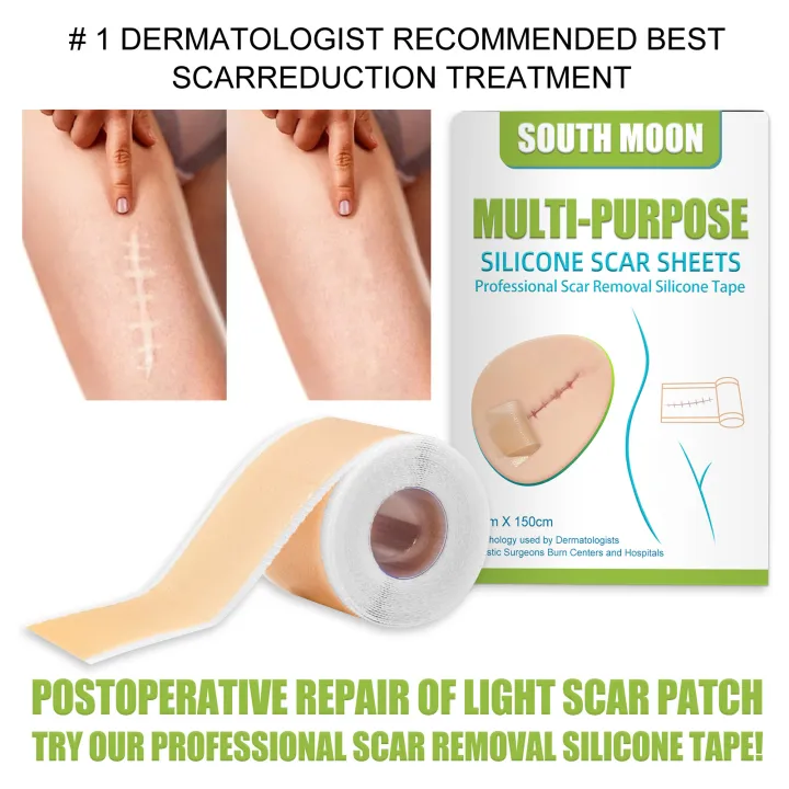 JKS%EF%BC%884*150cm%EF%BC%89South%20Moon%20Silicone%20Scar%20Sheet%20High%20Efficiency%20Surgical%20Silicone%20Gel%20Tape%20Removal%20Scar%20Tape%20Treatment%20-%20Image%203