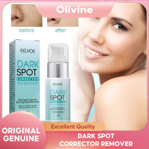 EELHOE Whitening Freckle Cream Nicotinamide Dark Spot Remover Skin Care Moisturizing Brighten Anti-aging Fade Spot Face Beauty Dark Spot Remover Skin Care Products Moisturizing Brighten Pigment Correction Face Beauty