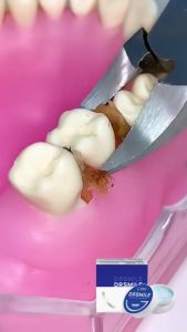 Dr Smile  Promo Probiotic Cleansing Whitening Tooth Powder Oral Care Toothpaste remove Bad Breath Pemutih Gigi 美白牙齿牙粉牙膏