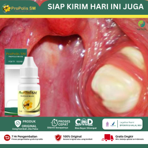 Obat Radang Amandel Amandel Bengkak Amandel Anak dan Dewasa Amandel Bernanah Sakit Tenggorokan Radang Tenggorokan - Propolis SM