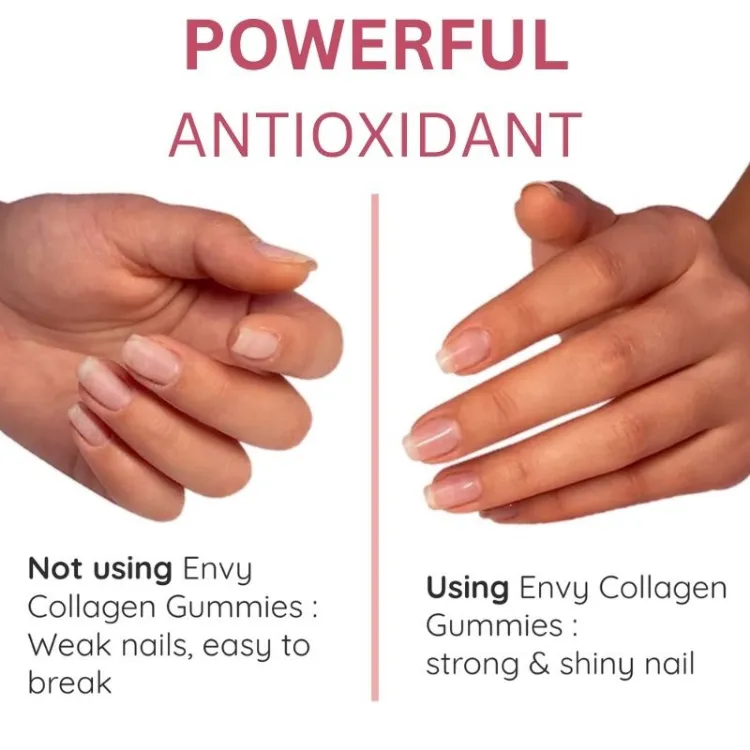 glutathione collagen glow envy Collagen Gummies Anti-aging Skin Beauty Whitening Vitamins Gummy 60 gummies Vitamin C And D Gummies - Lazada سيروم الإشراقة جلوتاثيون جلو من ميديكيوب Vitamin B12 Injection (Nature Bundle & Save!:2 Bottles (Save 5%)