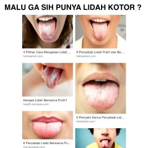 Pembersih Lidah / Tongue Cleaner