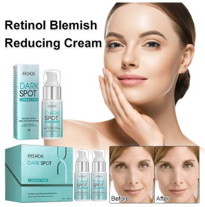 EELHOE Anti-freckle Essence Cream fades spots moisturizes rejuvenates brightens resists aging