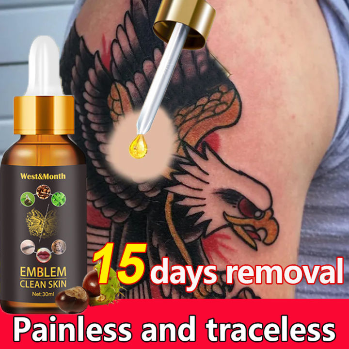 4PCS Tattoo Removal Cream Maximum Strength Remove Tattoo Gel Skin Cleaning  | eBay