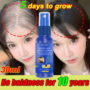 Eelhoe Ginger Hair Growth Spray Serum Anti Hair Loss Products Fast Growth Prevention Baldness Treatment Hair Dry Frizzy Damaged Repair Germinal Liquid（30ml）