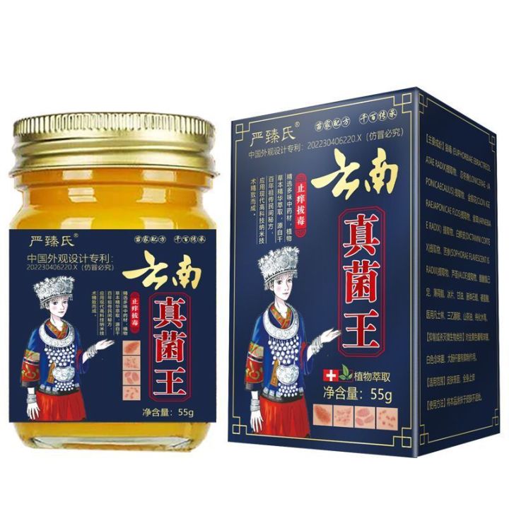 2026新品云南真菌王皮肤瘙痒特效止痒膏全身干燥瘙痒手脚干痒止痒杀菌外用Yunnan Fungus King Skin Pruritus ...