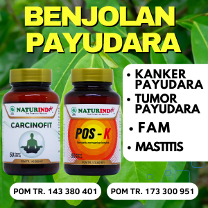 obat benjolan payudara kiri sebelah Kanan Fam