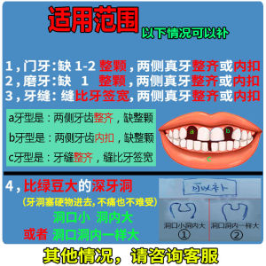 Simulation Universal Tooth Socket Eating Non-Hole Artifact Elderly Whitening Temporary Dentures Filling Missing Teeth Teeth Joint Filling Universal