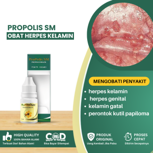 Obat Herpes Kelamin Pria Obat Penghancur Kutil Kelamin Obat Herpes Genital Obat Penyakit HPv Kelamin Obat Kelamin Gatal Perontok Kutil Papiloma Obat Herpes Di Kulit Kelamin - Propolis SM